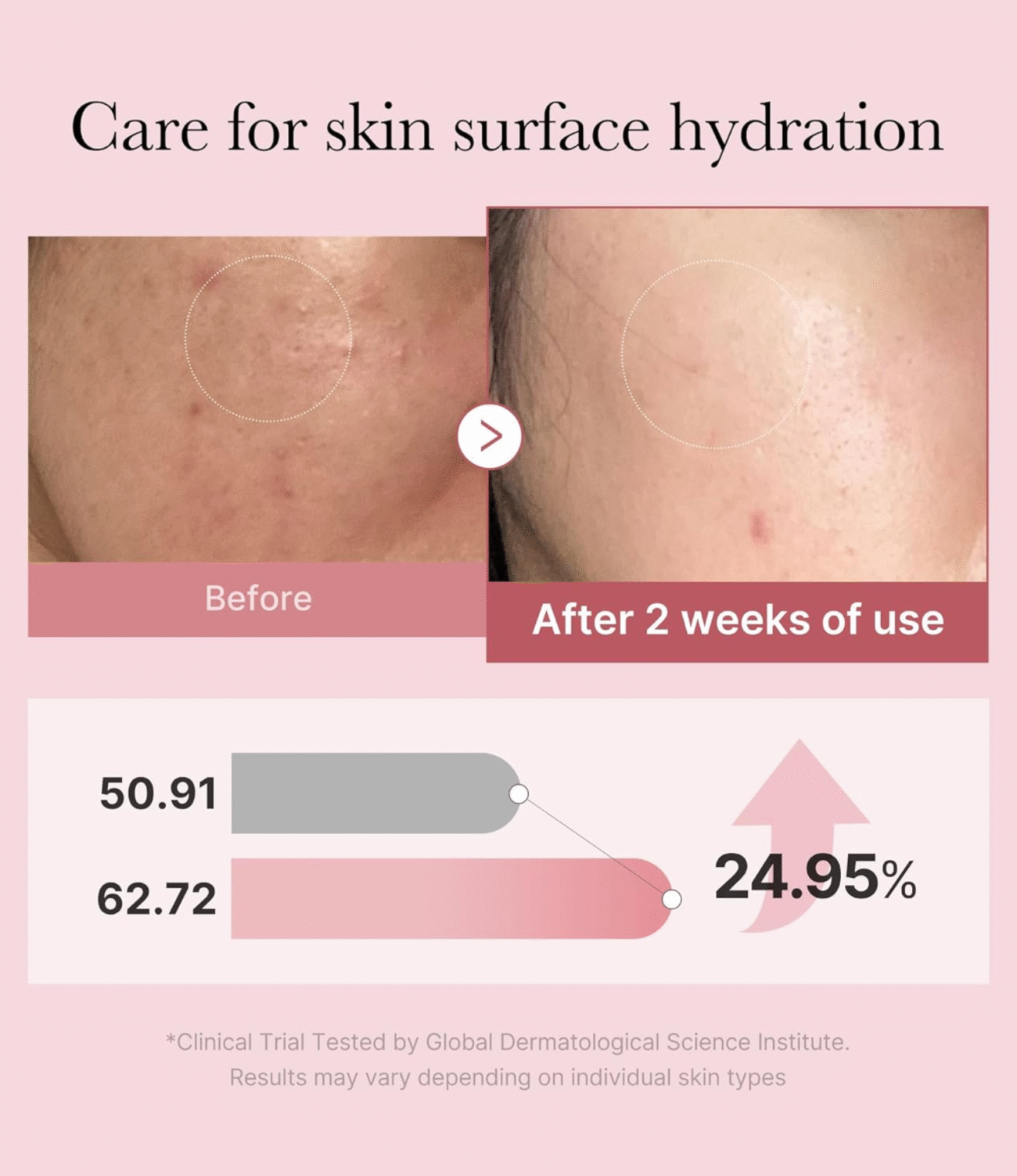 MEDICUBE - PDRN Pink Glutathione Serum Mist 100ml - Image 3